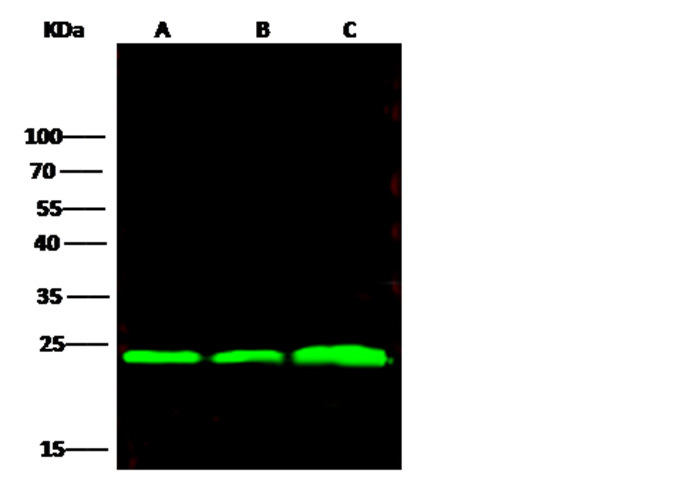 Recombinant BLVRB/biliverdin reductase B Monoclonal Antibody