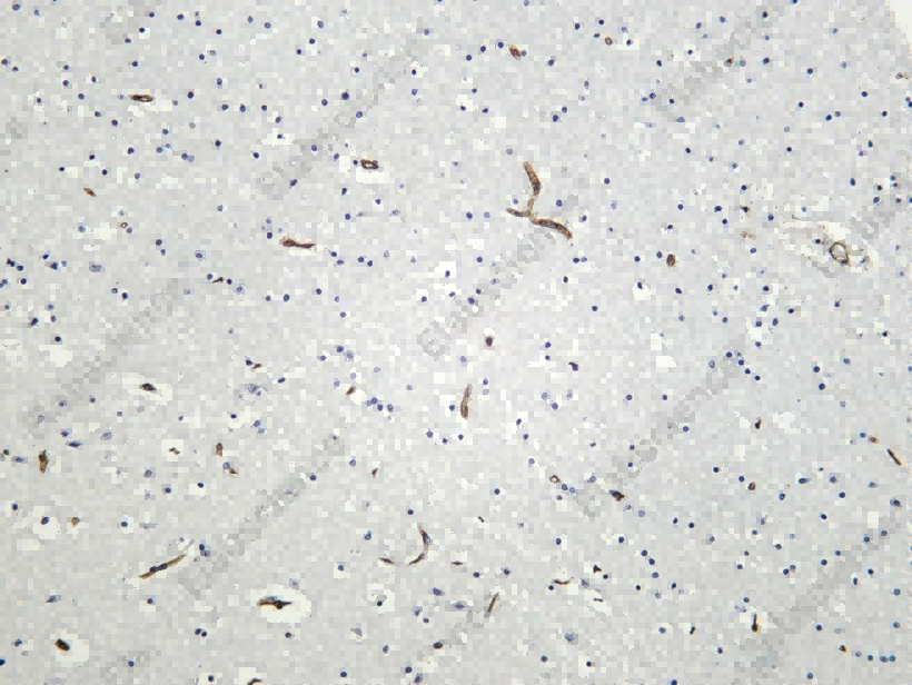 Recombinant PODXL Monoclonal Antibody - 1