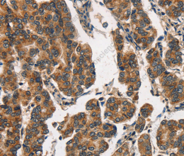 ITGA2 Polyclonal Antibody - 3