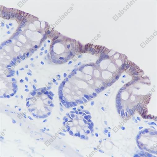 Recombinant Cadherin-17 Monoclonal Antibody - 3