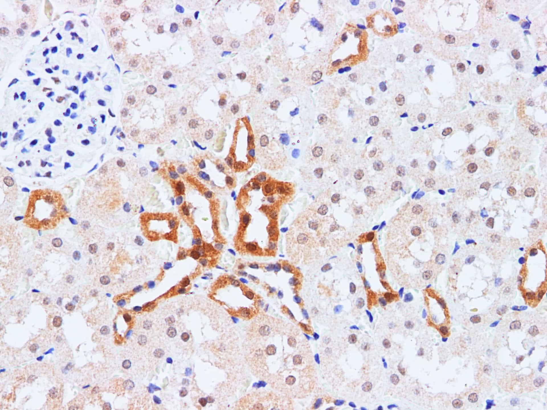 Immunohistochemistry of paraffin-embedded Rat kidney using HSPA1A Polyclonal Antibody at dilution of 1:200