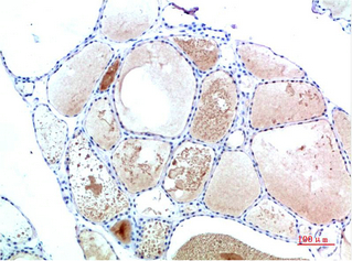 Immunohistochemistry of paraffin-embedded Human Thyroid tissue using TTR Monoclonal Antibody at dilution of 1:200.