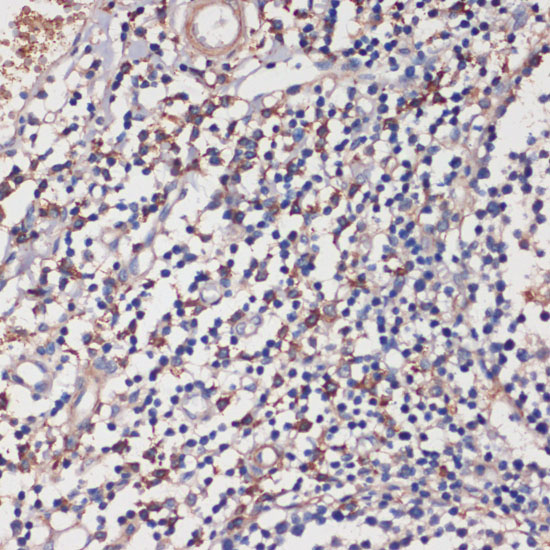 Immunohistochemistry of paraffin-embedded Human tonsil using TLR5 Polyclonal Antibody at dilution of  1:100 (40x lens).