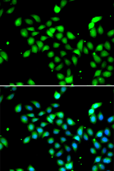 Immunofluorescence analysis of A549 cells using METTL13 Polyclonal Antibody Blue: DAPI for nuclear staining.
