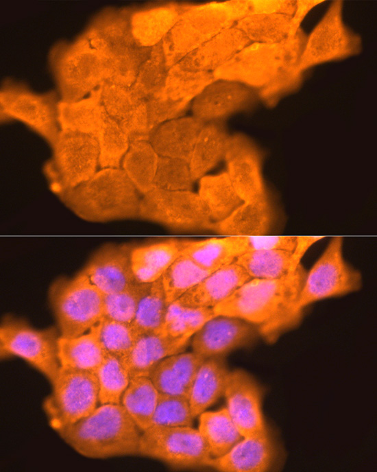 Immunofluorescence analysis of A431 cells using LORICRIN Polyclonal Antibody at dilution of 1:200 (40x lens). Blue: DAPI for nuclear staining.