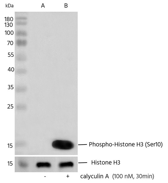 Recombinant Phospho-Histone H3 (Ser10) Monoclonal Antibody - small - 3