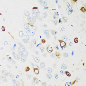 Immunohistochemistry of paraffin-embedded rat brain using ELAVL2 Polyclonal Antibody at dilution of 1:200 (40x lens).Perform microwave antigen retrieval with 10 mM PBS buffer pH 7.2 before commencing with IHC staining protocol.