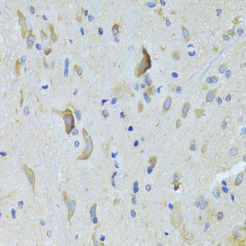 Immunohistochemistry of paraffin-embedded Rat spinal cord using SARS Polyclonal Antibody at dilution of  1:100 (40x lens).