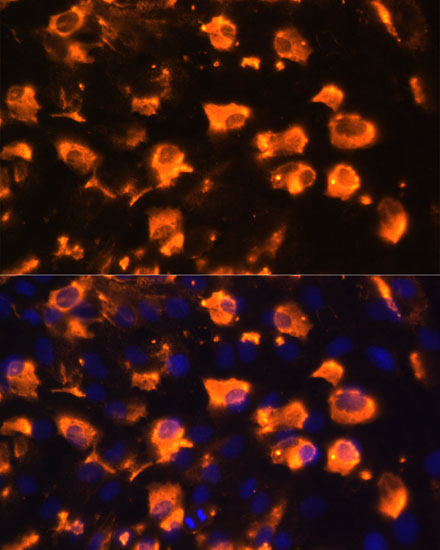 Immunofluorescence analysis of C6 cells using JAG2 Polyclonal Antibody at dilution of  1:100. Blue: DAPI for nuclear staining.