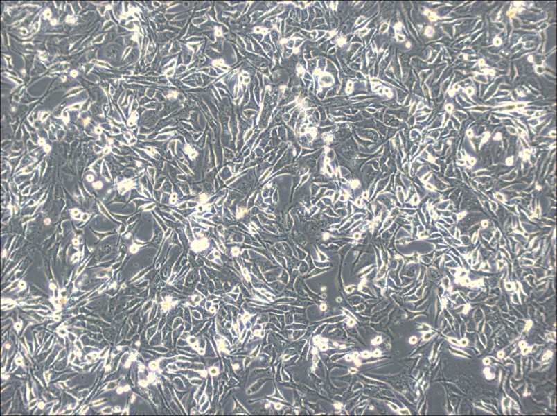 NCI-H596 Cell Complete Medium - 3