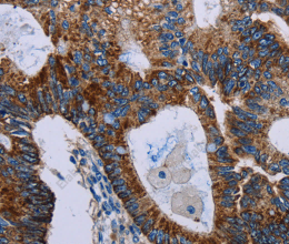 JAM-A Polyclonal Antibody - 3