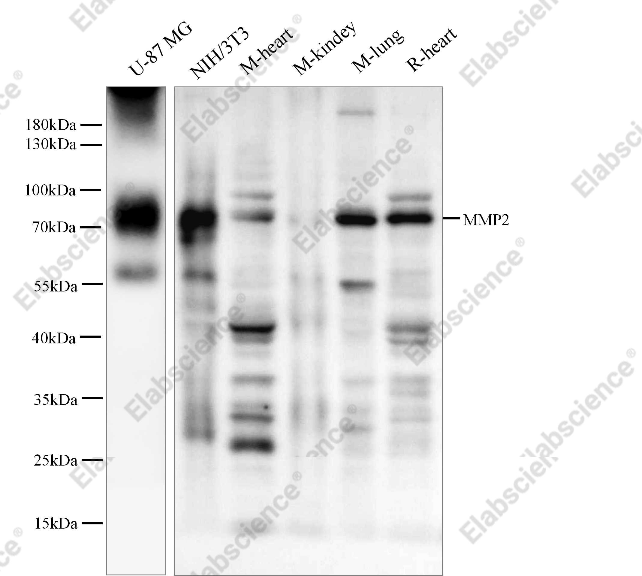 Recombinant MMP-2 Monoclonal Antibody - 1