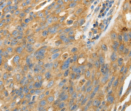 CALR Polyclonal Antibody - 3