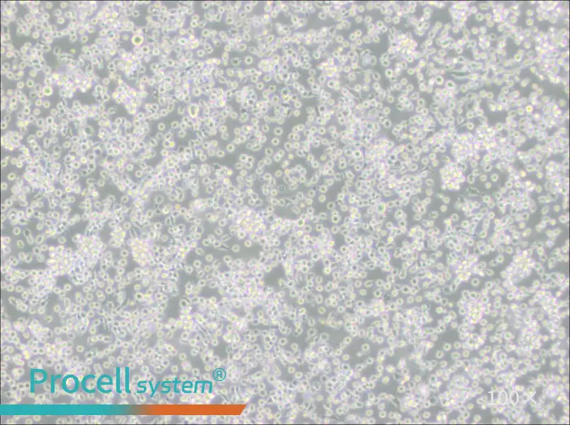 ARH-77 Cell Complete Medium - 1