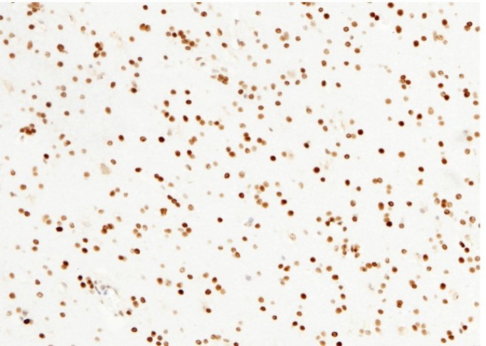 PARP-1/PARP Monoclonal Antibody - small - 4