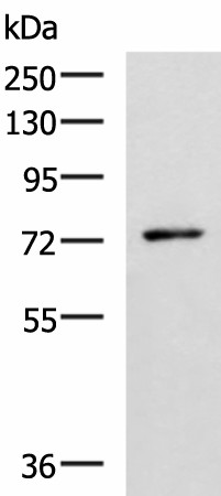 Western blot analysis of Mouse thymus tissue lysate  using L3MBTL2 Polyclonal Antibody at dilution of 1:1000