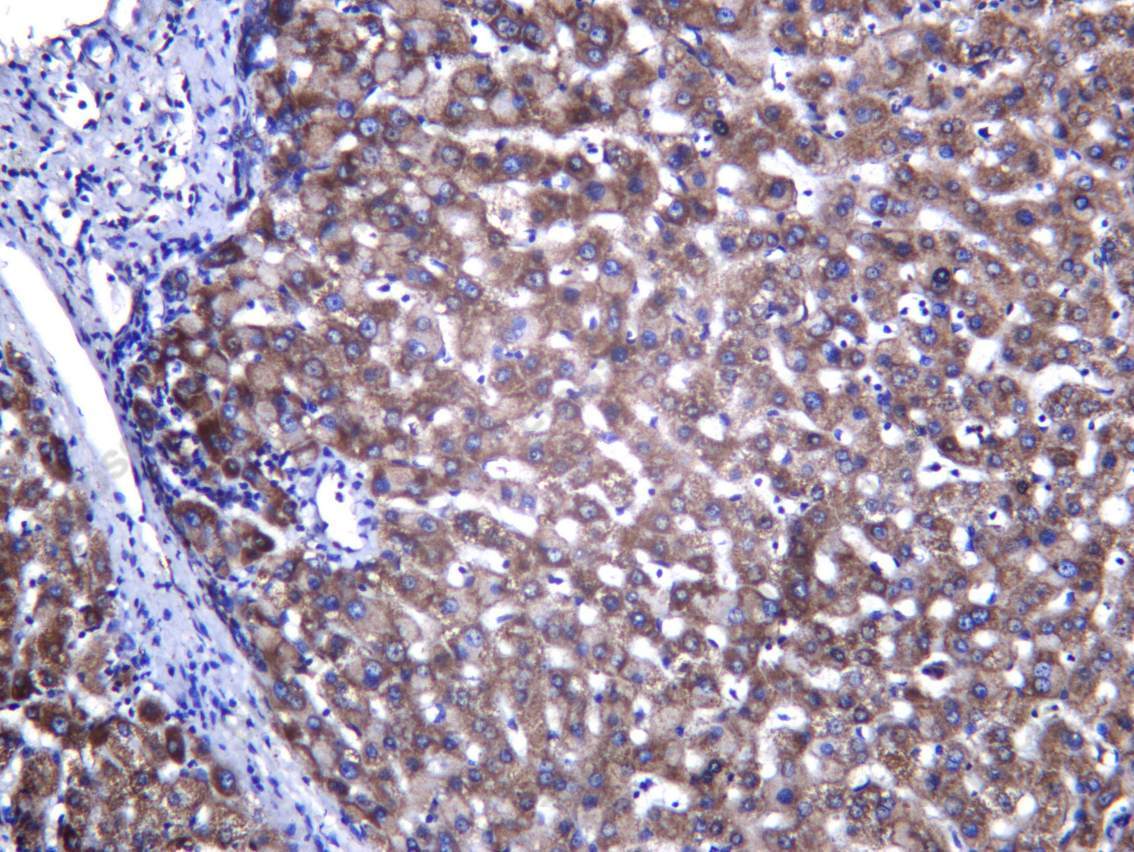 Recombinant ECHA Monoclonal Antibody - 2