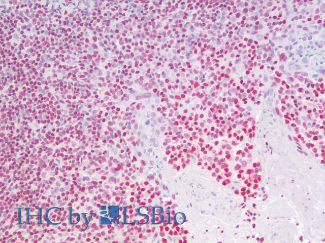 Immunohistochemistry analysis of paraffin-embedded Human Tonsil using HMGB1 Polyclonal Antibody(Elabscience Product Detected by Lifespan).