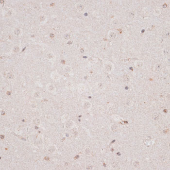 Immunohistochemistry of paraffin-embedded Mouse brain using KDM3A Polyclonal Antibody at dilution of 1:100 (40x lens).