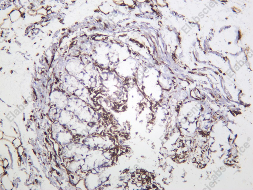 Recombinant Vimentin Monoclonal Antibody - 5