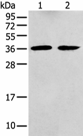 Western blot analysis of Mouse brain tissue and Human fetal brain tissue  using GNAI2 Polyclonal Antibody at dilution of 1:400