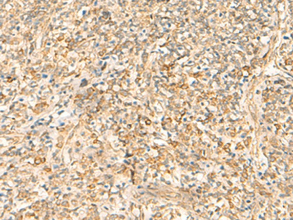 Immunohistochemistry of paraffin-embedded Human tonsil tissue  using EMC1 Polyclonal Antibody at dilution of 1:35(?200)