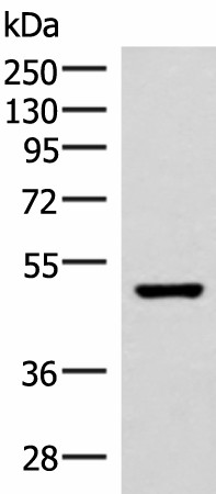 Western blot analysis of Mouse brain tissue lysate  using IP6K2 Polyclonal Antibody at dilution of 1:500