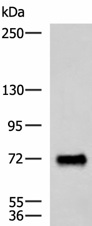 Western blot analysis of Human fetal brain tissue lysate  using PPEF1 Polyclonal Antibody at dilution of 1:1500