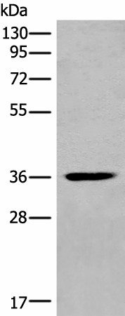 Western blot analysis of Mouse heart tissue lysate  using MEDAG Polyclonal Antibody at dilution of 1:700