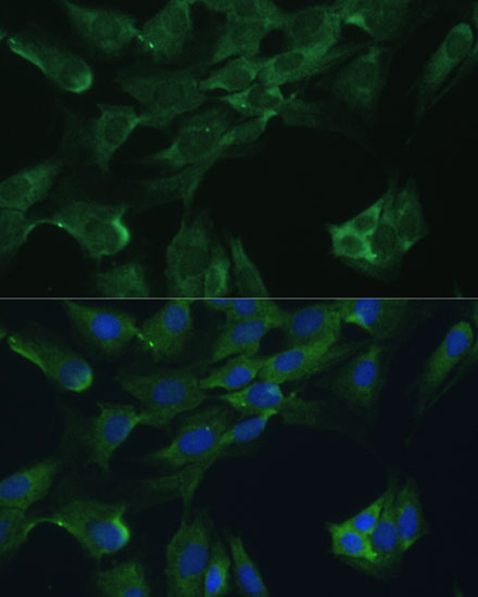 Immunofluorescence analysis of C6 cells using ADA Polyclonal Antibody at dilution of  1:100. Blue: DAPI for nuclear staining.