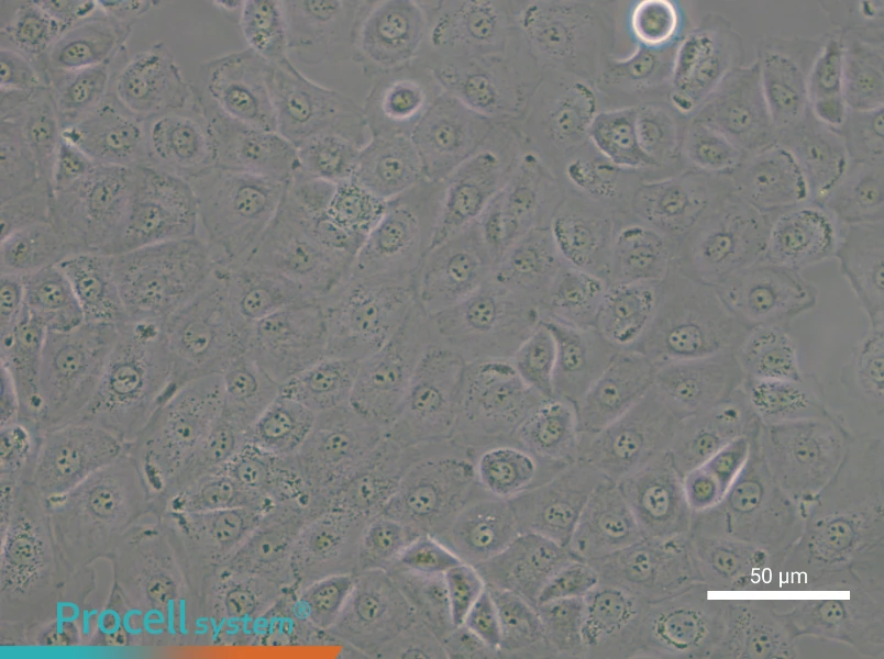NIH:OVCAR-3 [OVCAR3] - 4