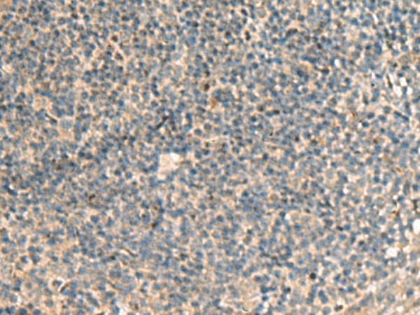 Immunohistochemistry of paraffin-embedded Human tonsil tissue  using POFUT1 Polyclonal Antibody at dilution of 1:50(?200)