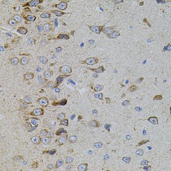 Immunohistochemistry of paraffin-embedded Rat brain using MAPK11 Polyclonal Antibody