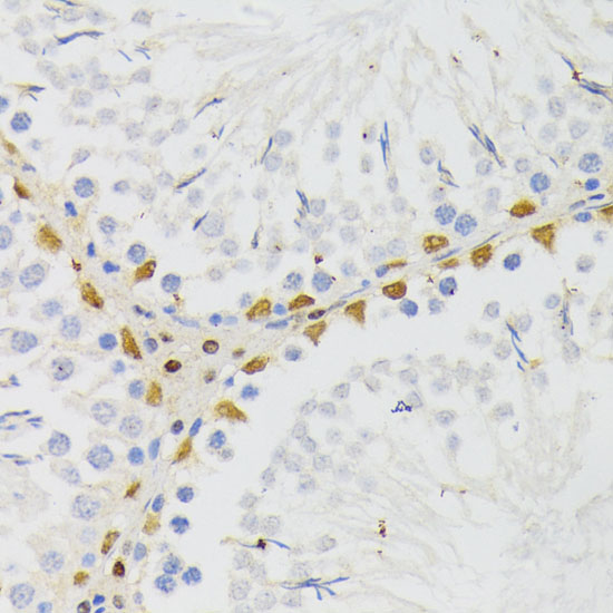 Immunohistochemistry of paraffin-embedded rat testis using ELAC2 Polyclonal Antibody at dilution of 1:200 (40x lens).Perform microwave antigen retrieval with 10 mM PBS buffer pH 7.2 before commencing with IHC staining protocol.