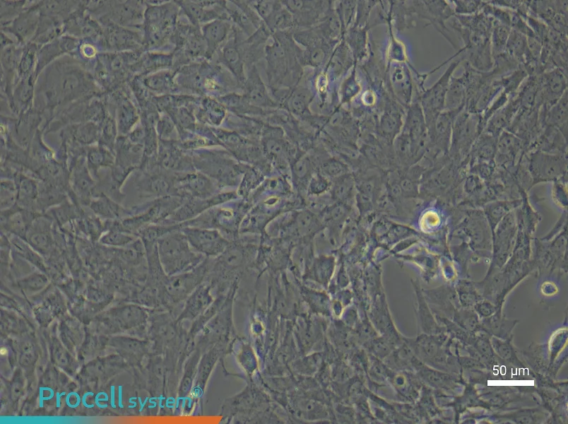 Rat Skeletal Muscle Fibroblast Complete Medium - 5