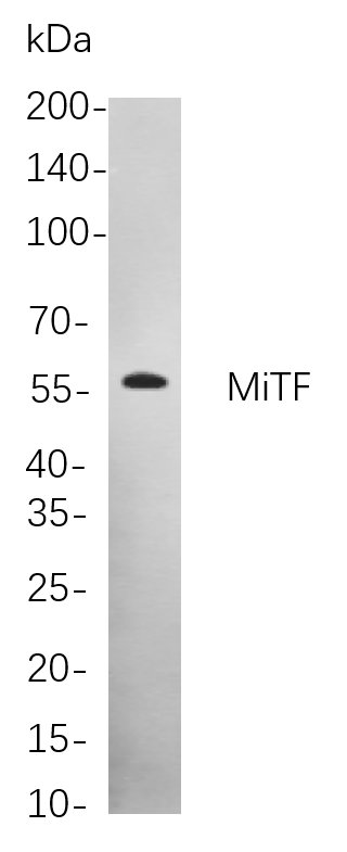 Recombinant MiTF Monoclonal Antibody-searchlist-1
