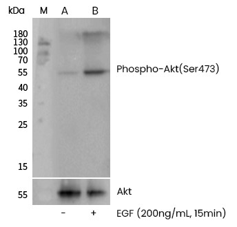 Recombinant Phospho-AKT (Ser473) Monoclonal Antibody - small - 4
