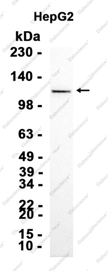 Recombinant Lipin 1 Monoclonal Antibody - 2