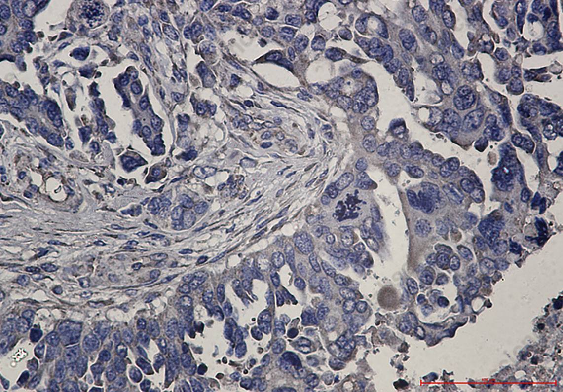 Recombinant RENT1 Monoclonal Antibody - 3