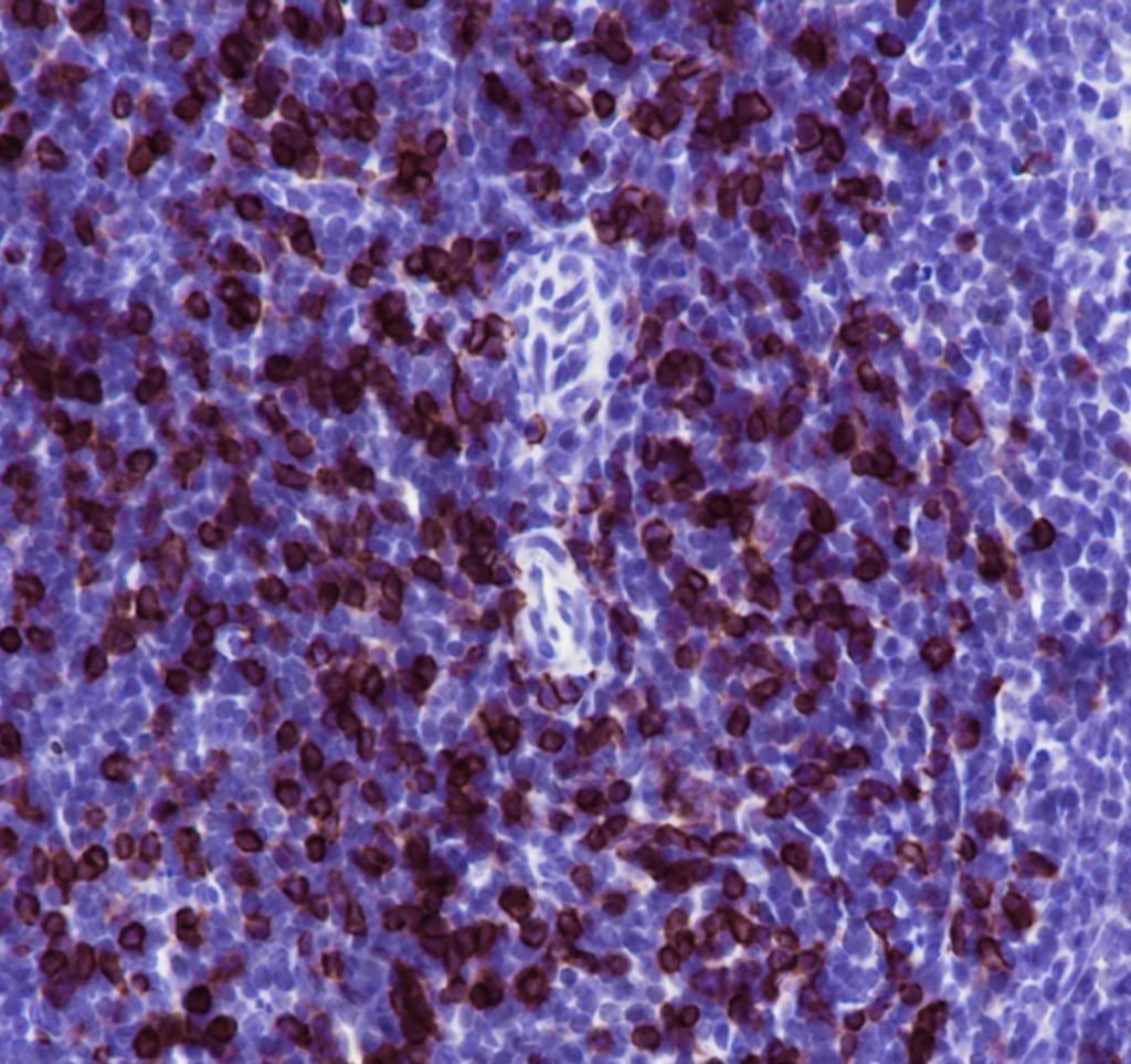 Recombinant CD8 beta Monoclonal Antibody - 2