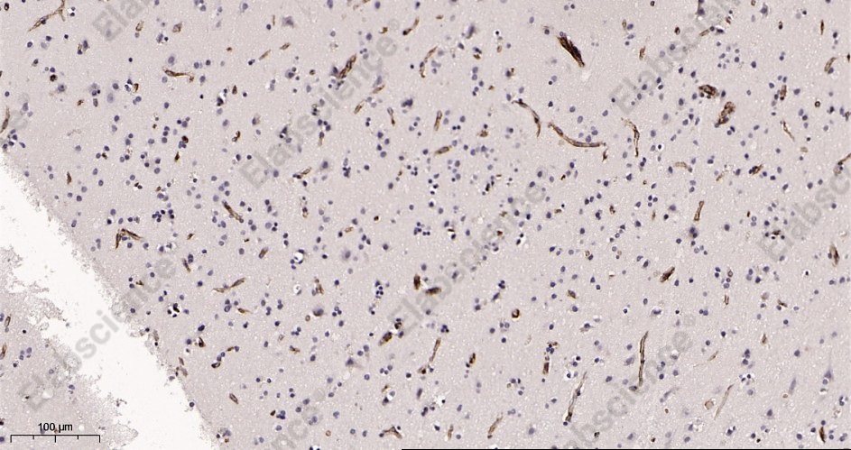 Recombinant IFITM3 Monoclonal Antibody - 2