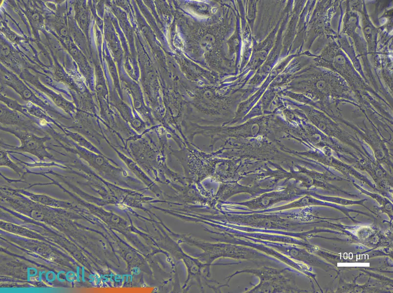 Human Endplate Chondrocyte Complete Medium - 1