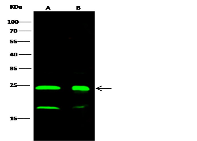 Recombinant PARK7/DJ-1 Monoclonal Antibody - small - 1