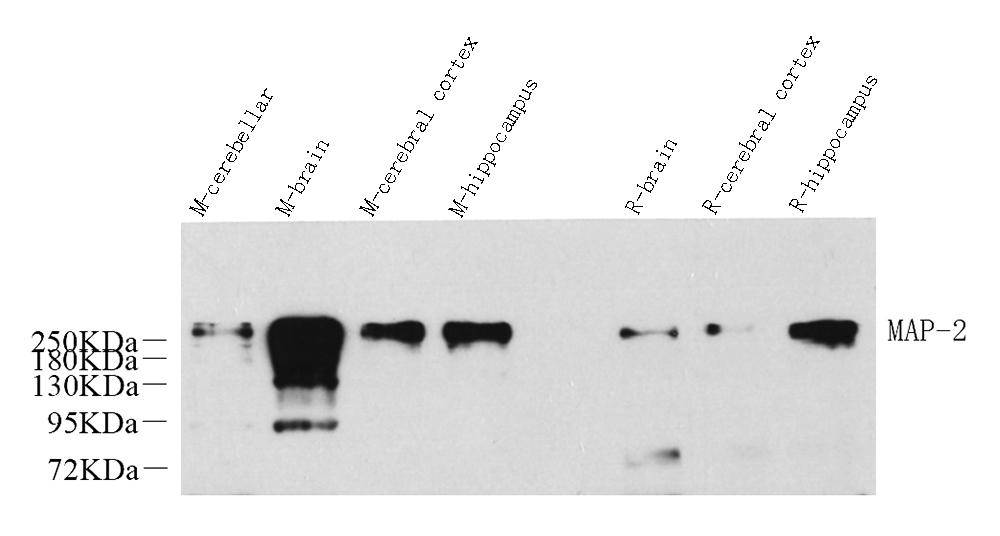 Western Blot analysis of various samples using MAP2 Polyclonal Antibody at dilution of 1:1000.