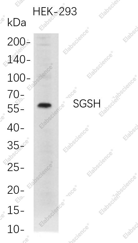 Recombinant SGSH Monoclonal Antibody - 1