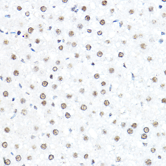 Immunohistochemistry of paraffin-embedded rat liver using SP1 Polyclonal Antibody at dilution of 1:50 (40x lens).Perform high pressure antigen retrieval with 10 mM citrate buffer pH 6.0 before commencing with IHC staining protocol.