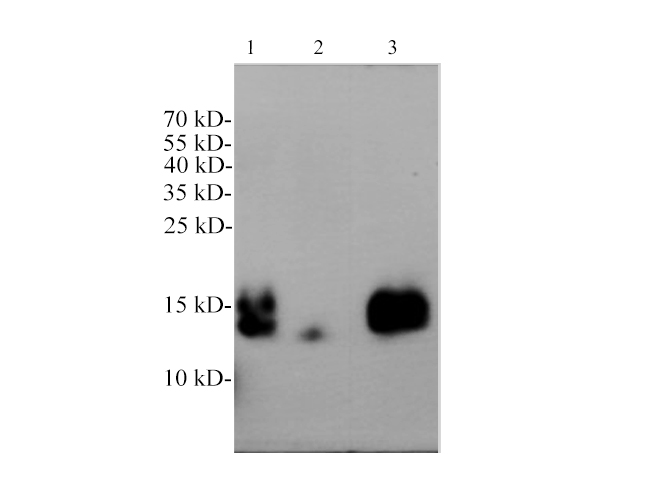 Western blotting with anti-Cys-C polyclonal antibody at dilution of 1:1000. Lane 1: Rat kidney lysate, lane 2: Rat liver lysate, lane 3: Rat plasma.