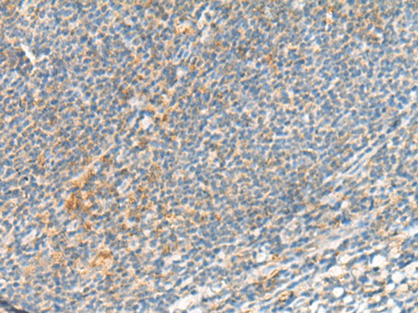 Immunohistochemistry of paraffin-embedded Human tonsil tissue  using TSHB Polyclonal Antibody at dilution of 1:95(?200)