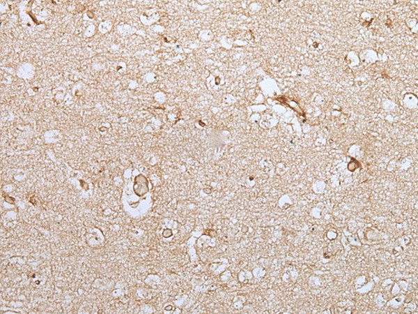 Immunohistochemistry of paraffin-embedded Human brain tissue  using HOXC9 Polyclonal Antibody at dilution of 1:35(?200)