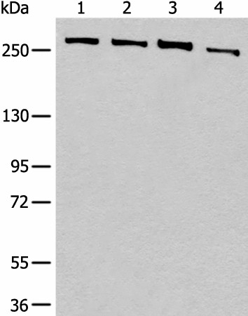 Western blot analysis of 293T cell lysates  using PRPF8 Polyclonal Antibody at dilution of 1:450